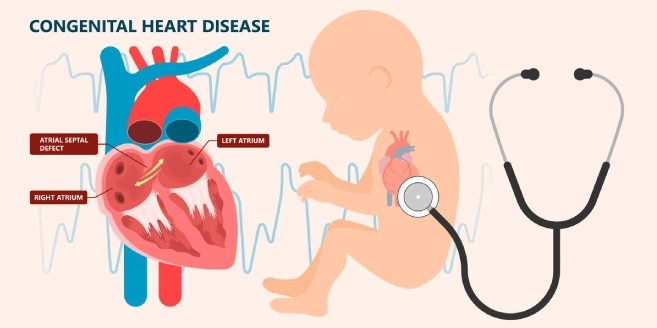 chẩn đoán dị tật tim bẩm sinh